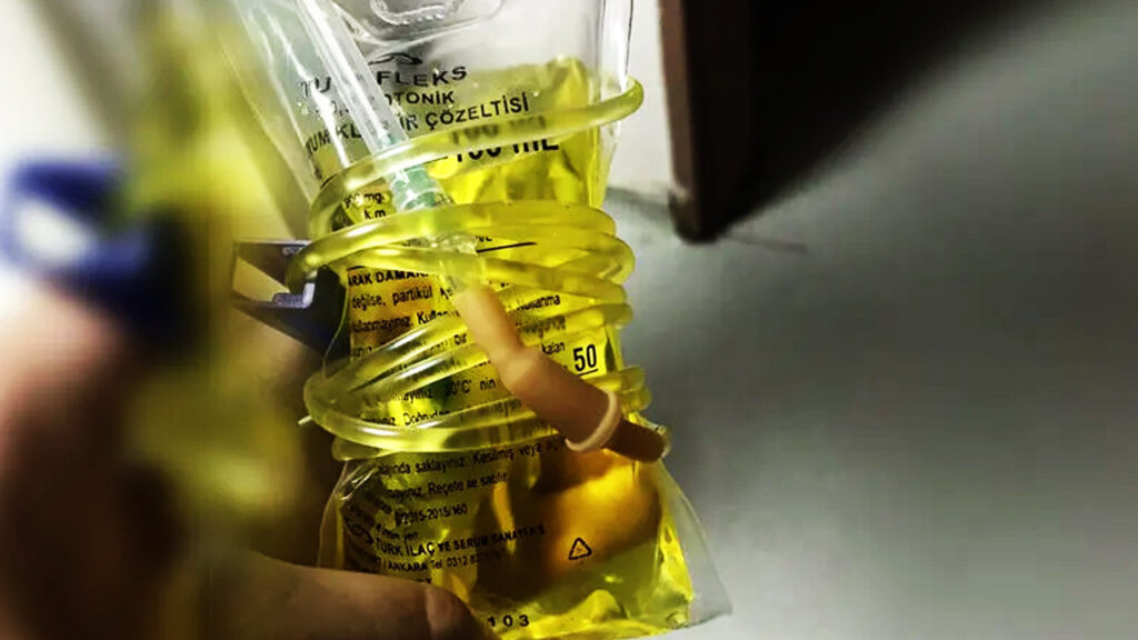 Evde Taktıranlar Büyük Tehlikede! Saniyeler İçinde Öldürebilir... Uzmanlardan 'Sarı Serum' Uyarısı