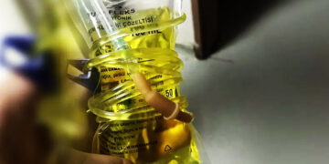 Evde Taktıranlar Büyük Tehlikede! Saniyeler İçinde Öldürebilir... Uzmanlardan 'Sarı Serum' Uyarısı