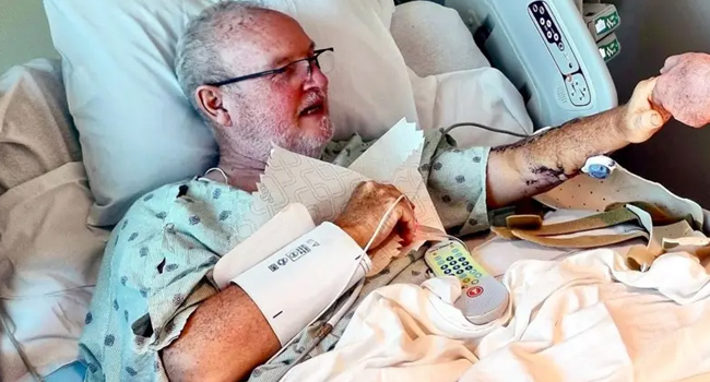 ‘Hayatımda hiçbir şeye bu kadar sert vurmadım’: Köpekbalığı saldırısına uğramak nasıl bir şey?