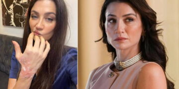 Eşref Rüya dizisinin setinde korkutan kaza: Ceren Benderlioğlu hastanelik oldu!