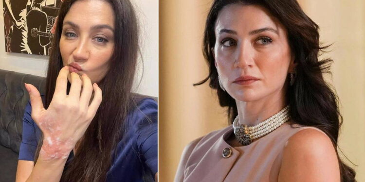 Eşref Rüya dizisinin setinde korkutan kaza: Ceren Benderlioğlu hastanelik oldu!