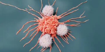 DSÖ açıkladı: Kanserde en büyük risk faktörü belli oldu