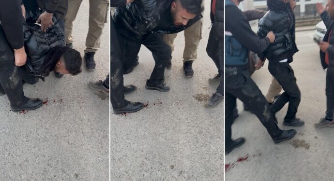 Önce darp ettiler sonra ‘arabadan düştü deriz’ dediler