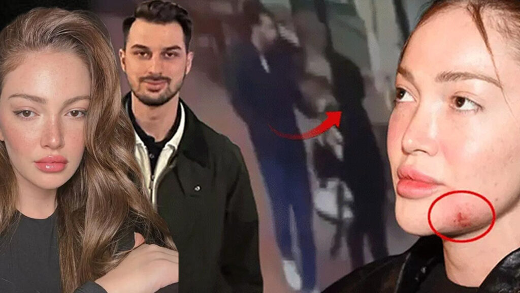 Danla Bilic'e Kabusu Yaşatmıştı! Eski Sevgili Berk Çetin'in Cezası Belli Oldu