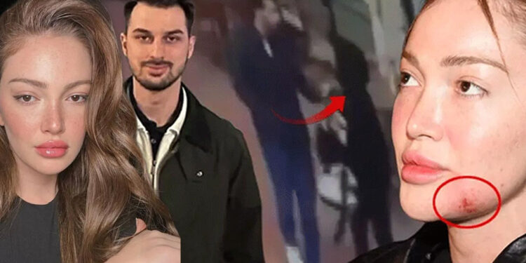 Danla Bilic'e Kabusu Yaşatmıştı! Eski Sevgili Berk Çetin'in Cezası Belli Oldu