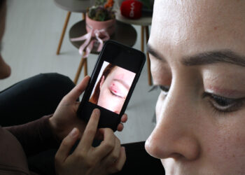 Güzellik Merkezi Kabusu! 1100 Liraya Yaptırdı, 150 Bin Liraya Düzeltilemiyor