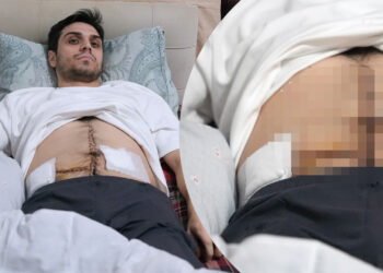 İstanbul'un Göbeğinde Dehşet! Saldırıya Uğrayan Çocuğa Yardım Etmek İstedi, 6 Yerinden Bıçaklandı