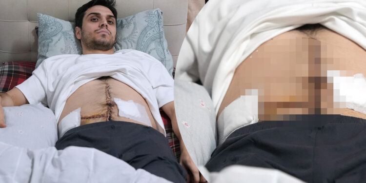 İstanbul'un Göbeğinde Dehşet! Saldırıya Uğrayan Çocuğa Yardım Etmek İstedi, 6 Yerinden Bıçaklandı