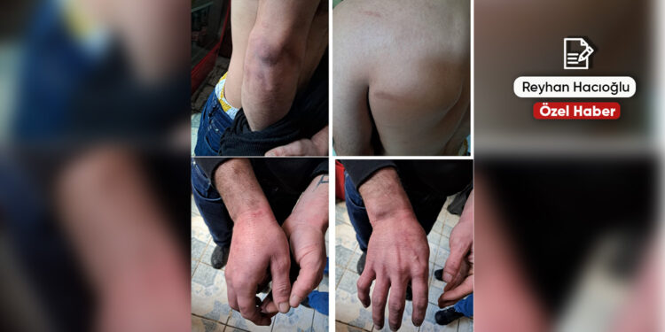 Hastanede darp: Acil servise gittiler, tutuklandılar