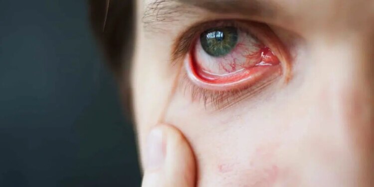 Ekrana bu kadar bakmayı bırakmanız gerekiyor!