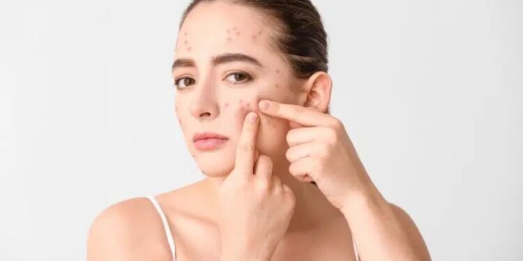 Pürüzsüz cilde kavuşmanızı sağlayan bakım rehberi: Sivilceden en hızlı kurtulmanın 7 yolu