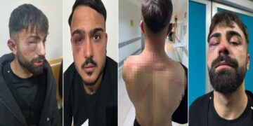 Newroz sonrasında gözaltına alınan gençlere işkence: Polisler hakkında suç duyurusu