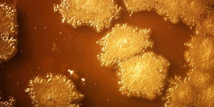 Kanser tedavisinde biyolojik devrim: Tümörü içeriden yok eden ‘akıllı’ bakteriler geliştirildi