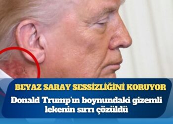 Donald Trump’ın boynundaki gizemli lekenin sırrı çözüldü
