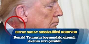 Donald Trump’ın boynundaki gizemli lekenin sırrı çözüldü