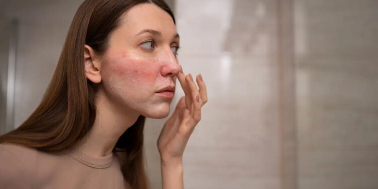 Asitli serumları kullanırken dikkat: Farkında olmadan cilde zarar veriyor…