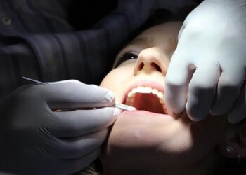 Diş eti hastalıklarını hafife almayın… Uzmanı uyardı: Kalp ve Alzheimer riskiyle ilişkili olabilir!