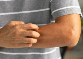 Vücuttaki o kaşıntıyı hafife almayın: Onkologlar uyardı, 4 farklı kanserin habercisi olabilir