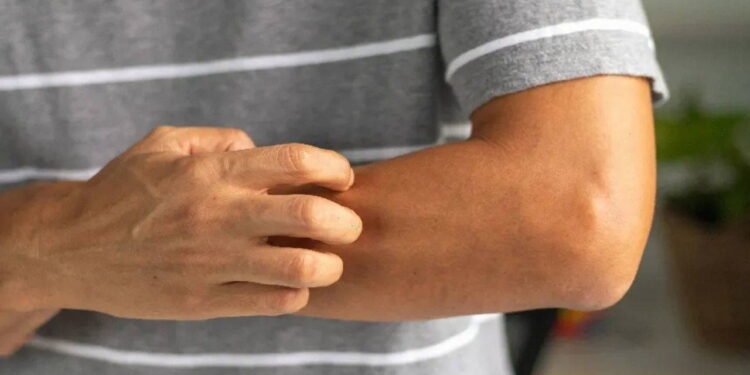 Vücuttaki o kaşıntıyı hafife almayın: Onkologlar uyardı, 4 farklı kanserin habercisi olabilir