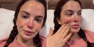 7 kez ameliyat olmuştu… Aslı Bekiroğlu taburcu olamadı: ‘Doktorlar ne yapacaklarını bilmiyorlar’