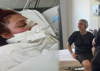 Güle Oynaya Girdiği Burun Ameliyatı Canında Etti