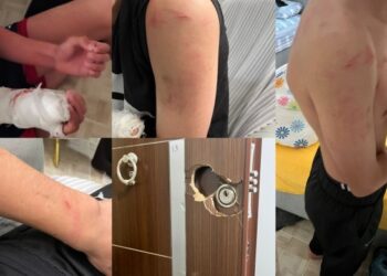 ‘Yanlış’ baskında kolu kırık çocuk darp edilmişti: Polisler hakkında suç duyurusu