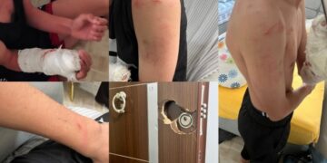 ‘Yanlış’ baskında kolu kırık çocuk darp edilmişti: Polisler hakkında suç duyurusu