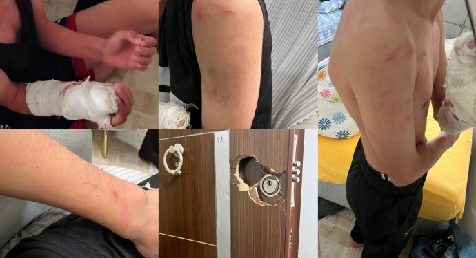 ‘Yanlış’ baskında kolu kırık çocuk darp edilmişti: Polisler hakkında suç duyurusu