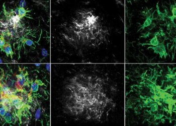 Alzheimer tedavisinde yeni ufuk: Beynin ‘temizlik ekibi’ yeniden programlandı