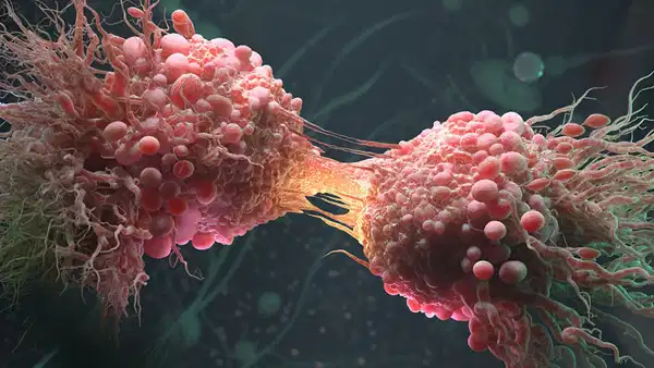 Onkoloji dünyasında alarm: 50 yaş altı genç nüfusta tırmanan kanser riskinin arkasında sinsi neden keşfedildi!
