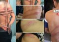 Gözaltında tecavüz: İşkence sistematik