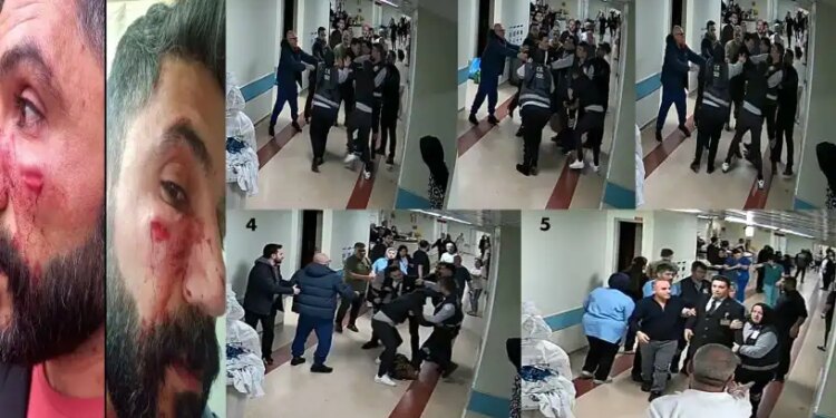Savcı saldırı görüntülerinde ses yok demişti: Kayıtlarda ses varmış