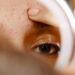 Yüzünüzdeki Kahverengi Lekelerin Tek Suçlusu Güneş Değil! Dermatolog Uyardı