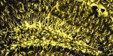 Beyinde hafızayı genç tutan gizli enzim bulundu: Beyindeki lipid temizliği zihinsel gerilemeyi engelliyor