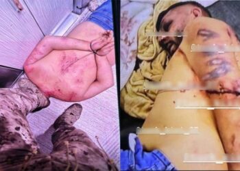 ATK’nin ‘var’ dediği polis işkencesine, başsavcılık ‘kovuşturmaya yer yok’ dedi