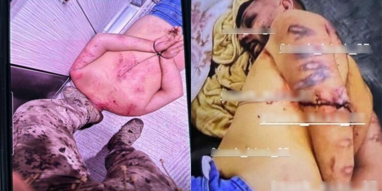ATK’nin ‘var’ dediği polis işkencesine, başsavcılık ‘kovuşturmaya yer yok’ dedi